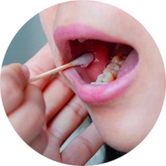 口腔棉签采样示例图